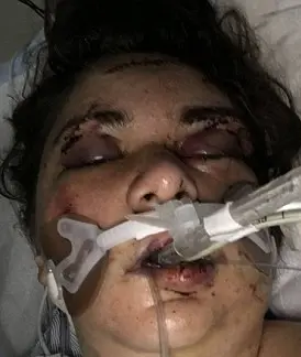 ضرب و شتم دختر جوان