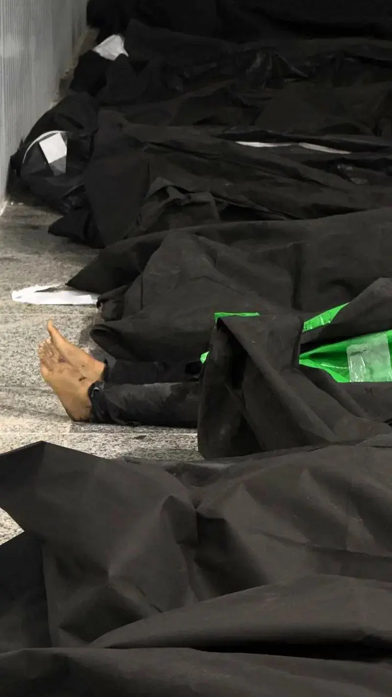 جسد+کودکان+میناب+