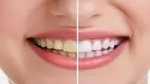 با این صیفی جات قرمز، لثه‌های خود را نجات دهید