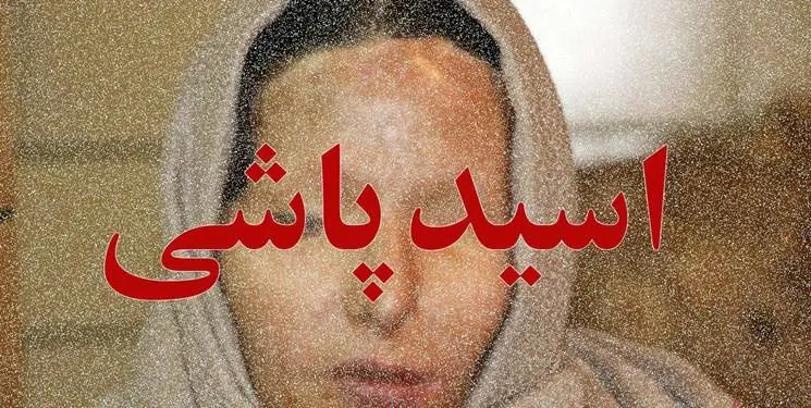 اسیدپاشی روی معلم کرجی
