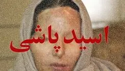 اسیدپاشی روی معلم کرجی