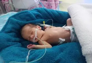 معجزه در پراید/ نوزاد نیمه‌زاده شده به زندگی بازگشت