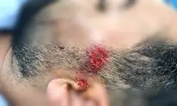 زخمی شدن مامور شرکت برق در حمله دارندگان ماینر