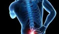 این دردها نشانه سیاتیک است