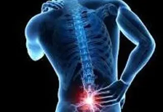 این دردها نشانه سیاتیک است