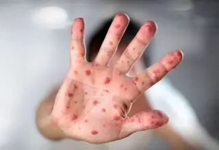 شناسایی ۶۷۴ مبتلا به 
