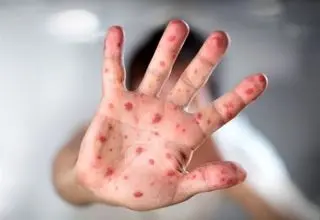 شناسایی ۶۷۴ مبتلا به 