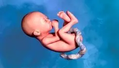 عوامل موثر بر سقط جنین را بشناسید