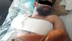 قطع دست کارگری که حقوقش فقط شش میلیون تومان بود