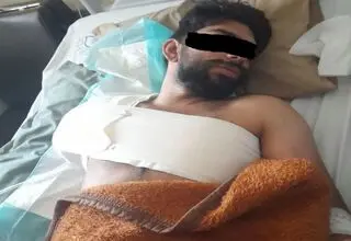 قطع دست کارگری که حقوقش فقط شش میلیون تومان بود