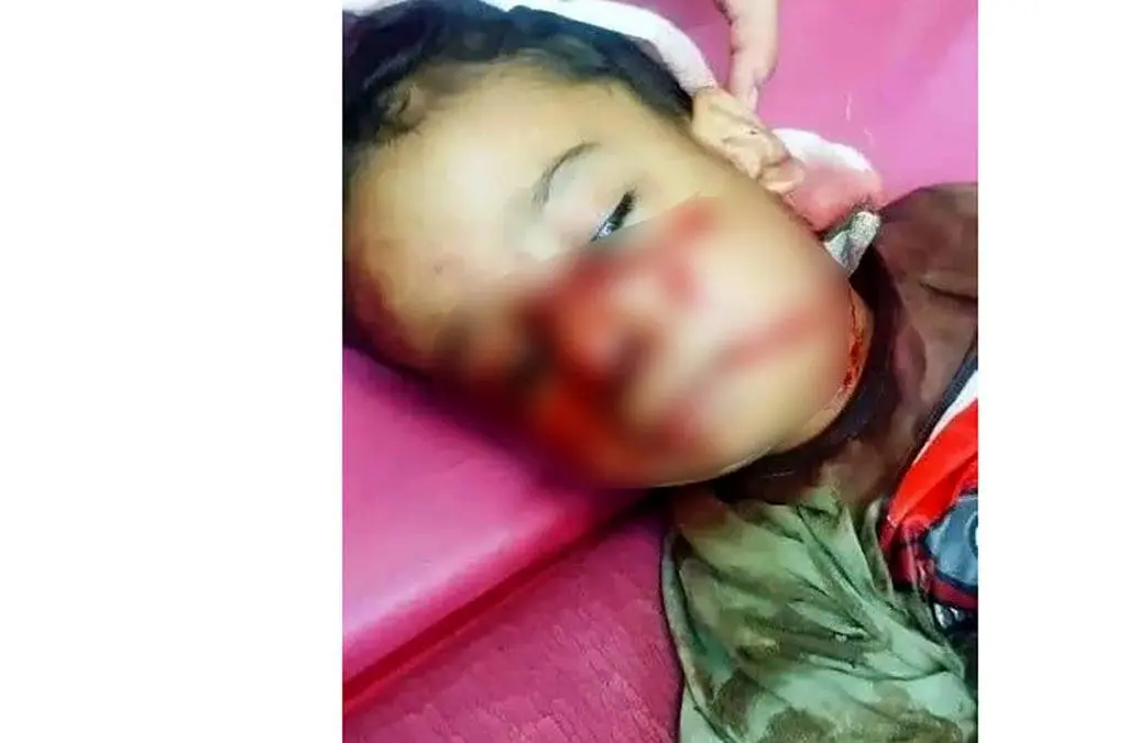کودک ۴ ساله قربانی حمله سگ‌های ولگرد در خوزستان + عکس