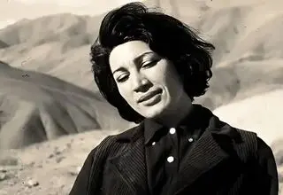 فروغ فرخزاد قبل و بعد از عمل بینی!