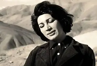 فروغ فرخزاد قبل و بعد از عمل بینی!