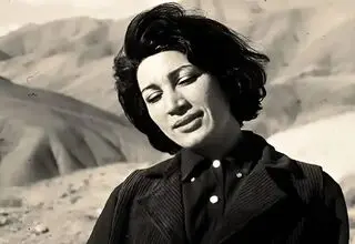 فروغ فرخزاد قبل و بعد از عمل بینی!
