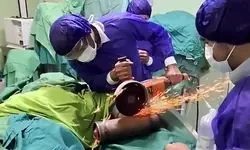 فیلم گیر کردن دست مرد جوان در چرخ گوشت