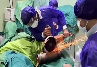 فیلم گیر کردن دست مرد جوان در چرخ گوشت