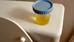 بوی غیرعادی ادرار نشانه بیماری‌ است؟