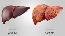 چهار عامل مهم ابتلا به کبد چرب