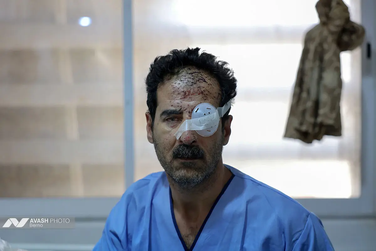 تصعید