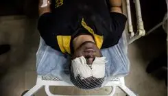 آنچه رئیس بیمارستان فارابی از مجروحان چشمی حوادث اخیر می‌گوید