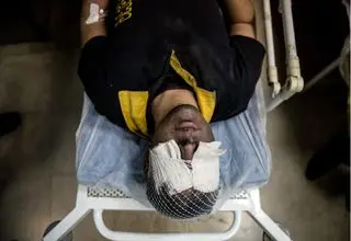 آنچه رئیس بیمارستان فارابی از مجروحان چشمی حوادث اخیر می‌گوید