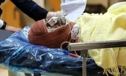 جزئیات بیشتر از حادثه انفجار مخزن سوخت در طالب‌آباد انزلی