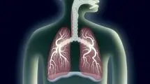 تاثیر آلودگی هوا بر کاهش عملکرد ریه 