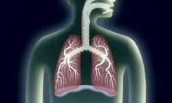 تاثیر آلودگی هوا بر کاهش عملکرد ریه 