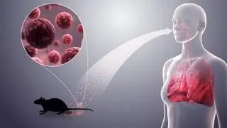 هانتاویروس چیست و از کجا آمده؟/ آمادگی ایران برای مقابله با هانتاویروس