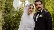 عکس پربازدیدِ متین ستوده قبل از عمل‌های زیبایی