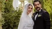 عکس پربازدیدِ متین ستوده قبل از عمل‌های زیبایی