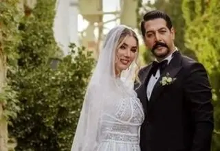 عکس پربازدیدِ متین ستوده قبل از عمل‌های زیبایی