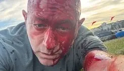 کشته شدن خاخام اسرائیلی و زخمی شدن رئیس شورای یهودیان استرالیا + عکس 