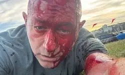 کشته شدن خاخام اسرائیلی و زخمی شدن رئیس شورای یهودیان استرالیا + عکس 