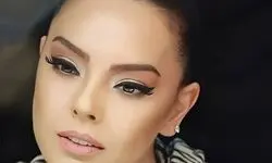 تغییر چهره ابرو گوندش بعد از عمل زیبایی/ عکس