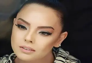 تغییر چهره ابرو گوندش بعد از عمل زیبایی/ عکس