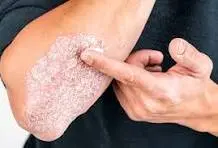 بیماریهای نادری که موجب مرگ میشوند