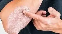 بیماری‌های نادری که موجب مرگ می‌شوند