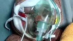 روایت مرگ «رایان» ۲ ماهه و اثر تحریم‌ها بر درمان مجروحان