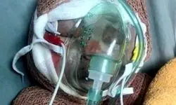 روایت مرگ «رایان» ۲ ماهه و اثر تحریم‌ها بر درمان مجروحان