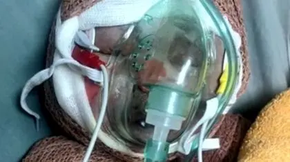 روایت مرگ «رایان» ۲ ماهه و اثر تحریم‌ها بر درمان مجروحان