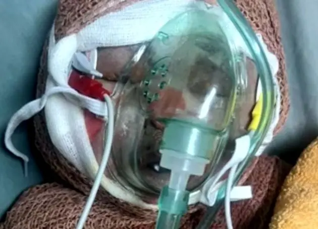 روایت مرگ «رایان» ۲ ماهه و اثر تحریم‌ها بر درمان مجروحان