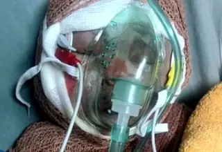 روایت مرگ «رایان» ۲ ماهه و اثر تحریم‌ها بر درمان مجروحان