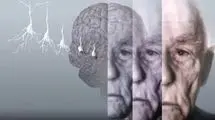 طراحی ابزار هوش مصنوعی برای تشخیص نوع و شدت زوال عقل