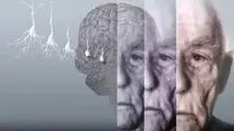 طراحی ابزار هوش مصنوعی برای تشخیص نوع و شدت زوال عقل