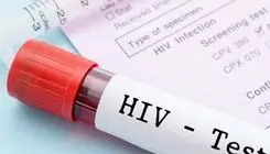 افزایش ۳ ‌برابری موارد مثبت ایدز در پویش وزارت بهداشت