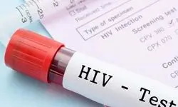 افزایش ۳ ‌برابری موارد مثبت ایدز در پویش وزارت بهداشت