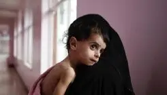 ۱۸۸ هزار کودک مبتلا به سوءتغذیه اعتبار خرید سبدغذایی رایگان گرفتند