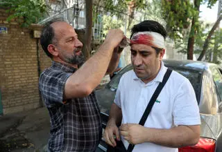 برای مجروحان سوختگی و جراحت انفجار چه باید کرد؟

