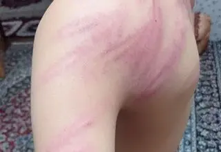 جزئیات اخراج معلمی که دانش آموزان را به شدت کتک زده بود